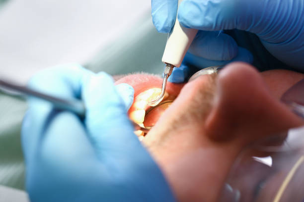 Best Emergency Dentist for Knocked-Out Tooth in Kaunakakai, HI